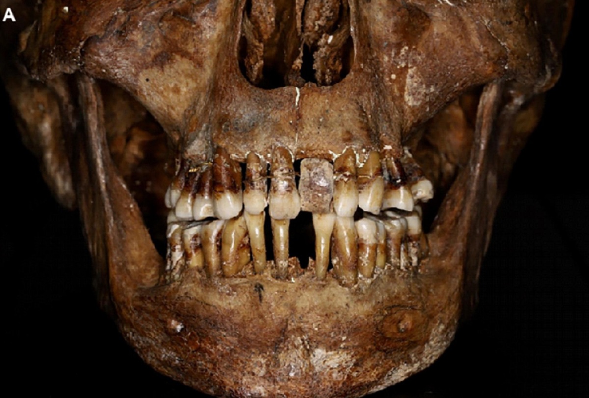 Co robił dentysta w 400 lat temu? Zęby bolą od samego opisu
